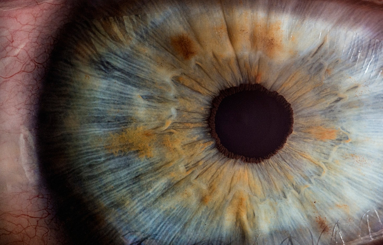 Diferencias entre lentes de contacto blandos y rígidos
