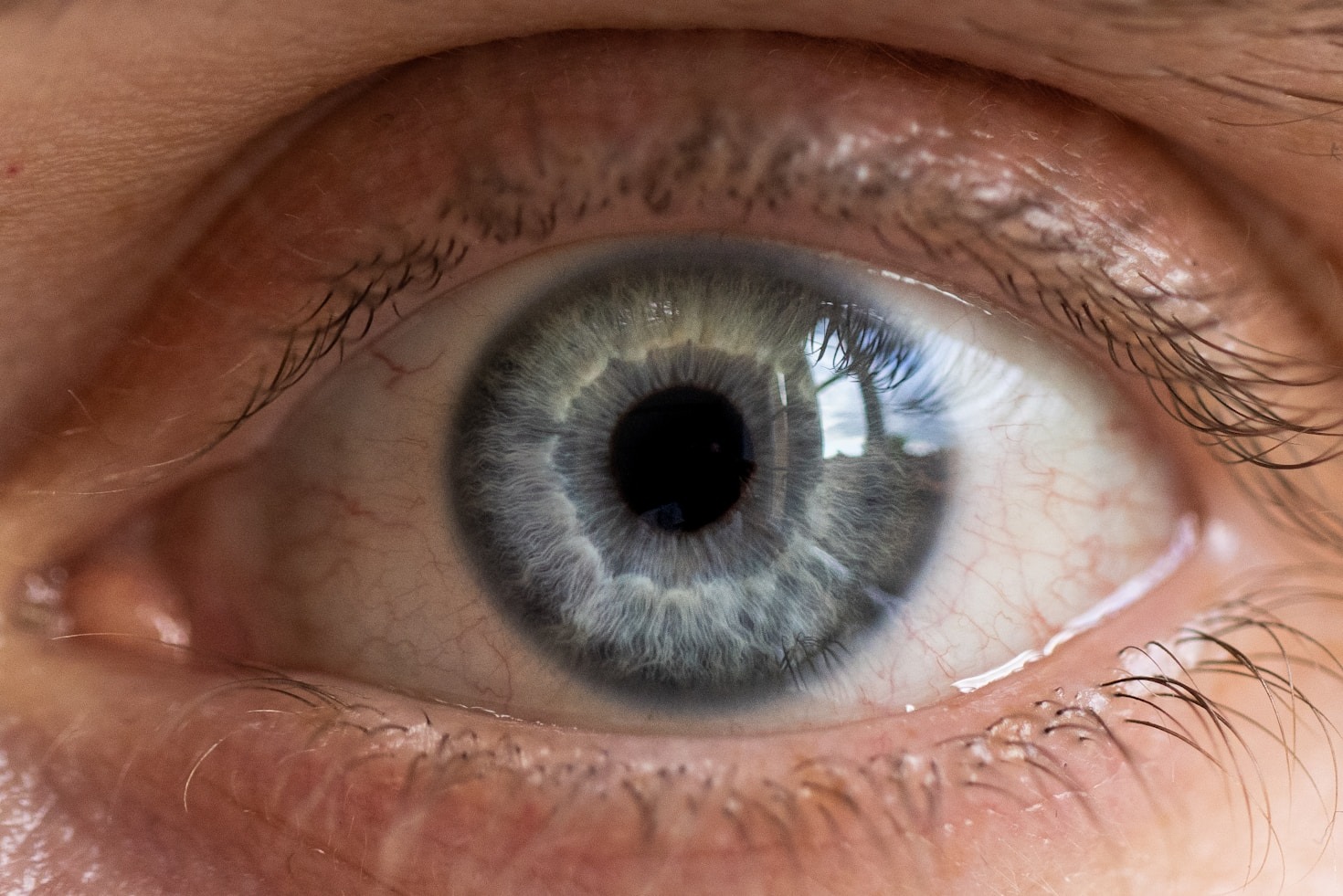 Guía básica para el mantenimiento de tus lentes de contacto